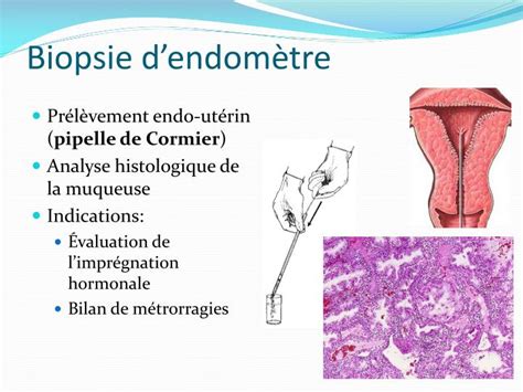 PPT Cancer de lendomètre PowerPoint Presentation ID 2157998