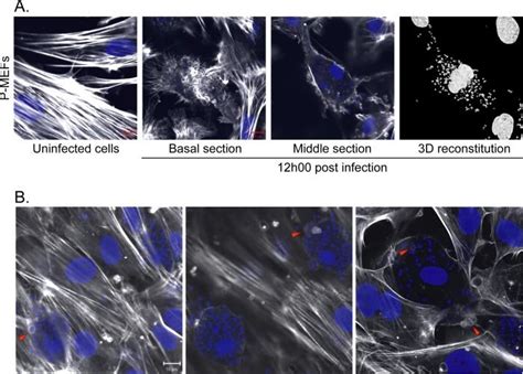 L Major Parasites Accumulate In P MEFs And Cause Actin Cytoskeleton