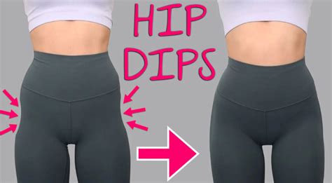 Tout Savoir Les Hip Dips Causes Et Traitements Medespoir Magazine