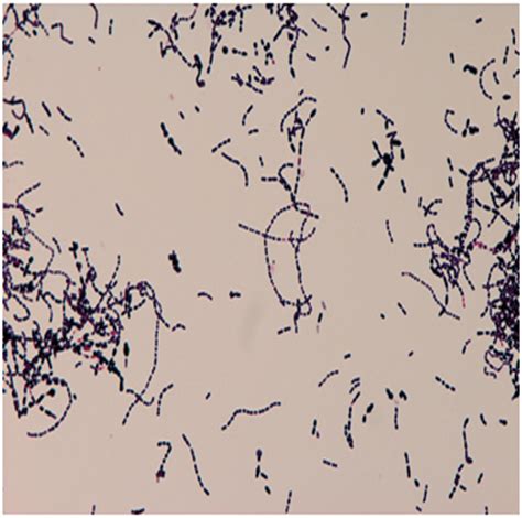 Streptococcus Bovis Identification