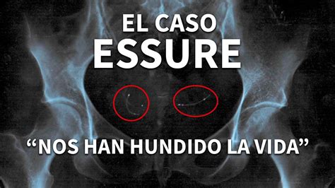 Violencia Ginecol Gica El Anticonceptivo Essure Youtube