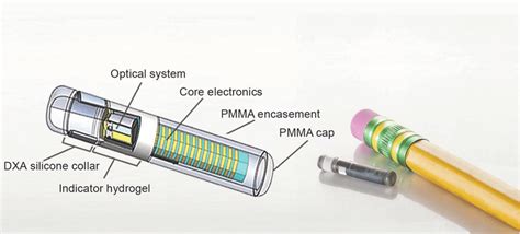 Eversense Ò implantable glucose sensor. DXA, dexamethasone acetate ...