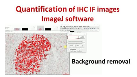 Quantification Of Immunohistochemistry Images Using ImageJ How To