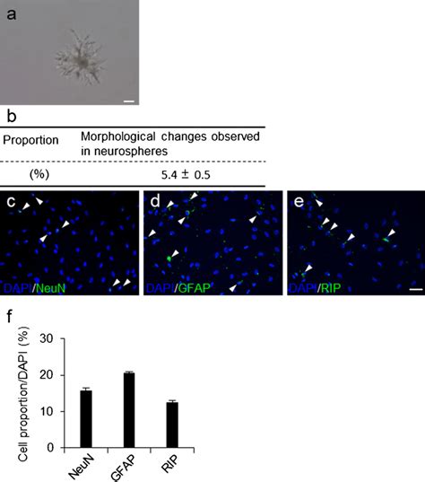 Differentiation Capacities Of Cd9 Positive Ependymal Cells A