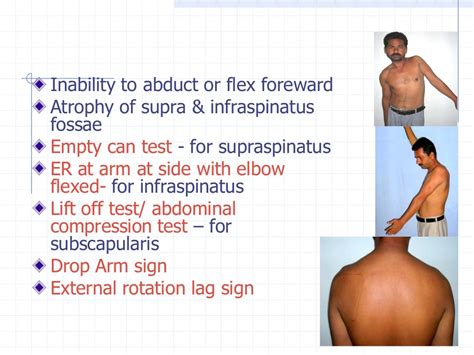 Shoulder Examination