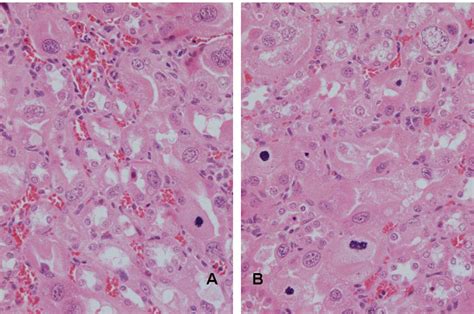 A B Renal Histopathology Of Rat After Weeks Exposure To P