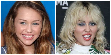 Are Miley Cyrus’ Teeth Real or Fake? | Longevita