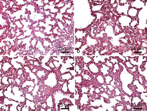 Histology Of Lung Tissue Section Of Lung Tissue Obtained From Fetus Of Download Scientific