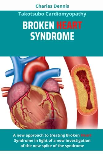 Broken Heart Syndrome Takotsubo Cardiomyopathy A New Approach Of