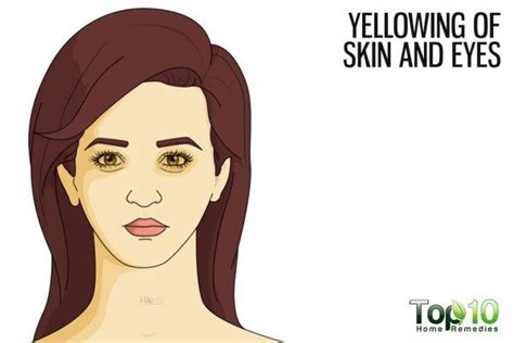 What Your Face Tells You About Your Health Top 10 Home Remedies