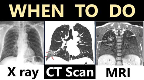 Choosing The Best Test For You X Ray CT Scan Or MRI Dr Education 26688 ...