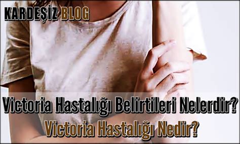 Victoria Hastalığı Belirtileri Nelerdir Victoria Hastalığı Nedir