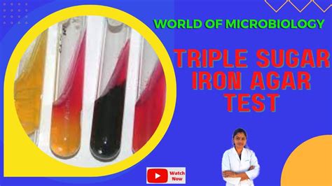 Triple Sugar Iron Tsi Agar Test Tamil Identification Of Bacteria