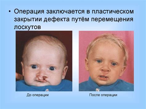 Аномалии и пороки развития - online presentation