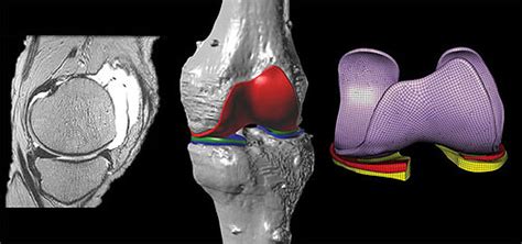 Realistic Simulation Probes Biomechanics Of Knees Engineering