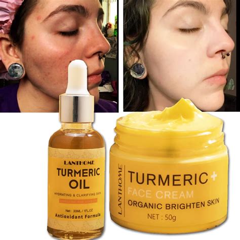 Ensemble De Soins De La Peau Au Curcuma Pour Le Visage R Tr Cissement