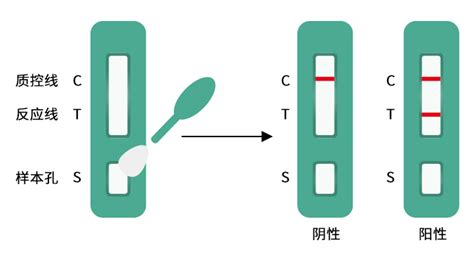 义翘神州助力首批新冠病毒抗体检测试剂上市 生物通