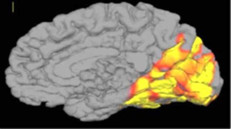 Neurofeedback For Migraines And NFB Protocol