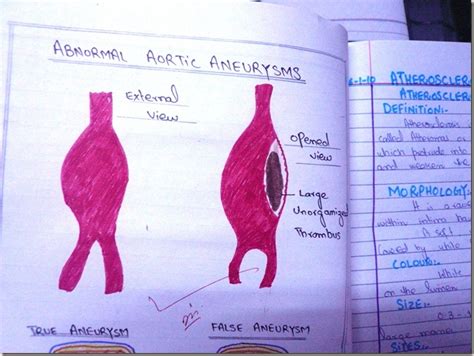 Histology Slides Database Aortic True Aneurysm And False Aneurysm Diagrams