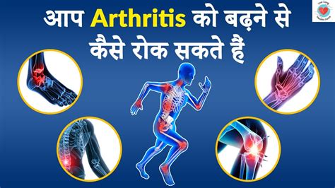 WHAT IS ARTHRITIS HOW TO STOP ARTHRITIS FROM PROGRESSING