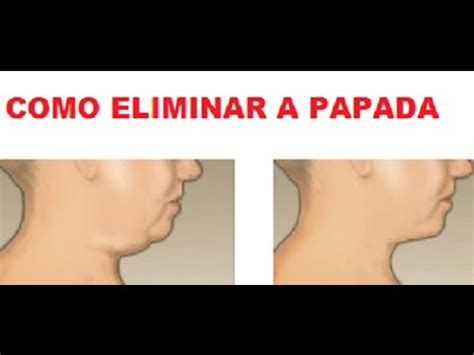 COMO ELIMINAR A PAPADA DUAS RECEITAS YouTube