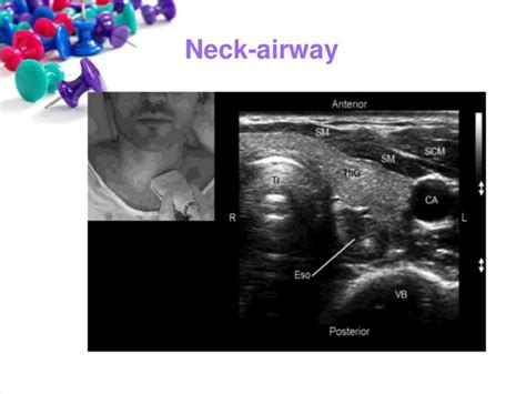 Role of ultrasound nurse in critical care