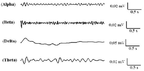 Eeg Signal Epoch Of 3s After Decomposition Of Frequency Bands Alpha