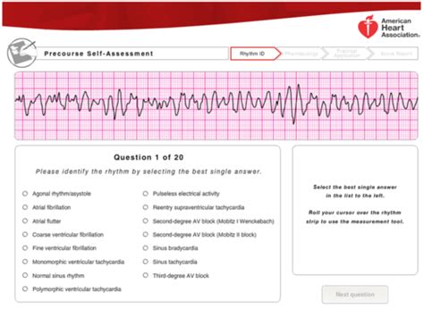 Acls Precoarse Assessment Rhythm Strips Flashcards Quizlet