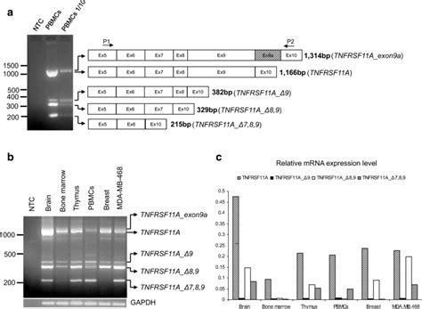 A Agarose Gel Electrophoresis Of The Pcr Products Using Primers P1 And