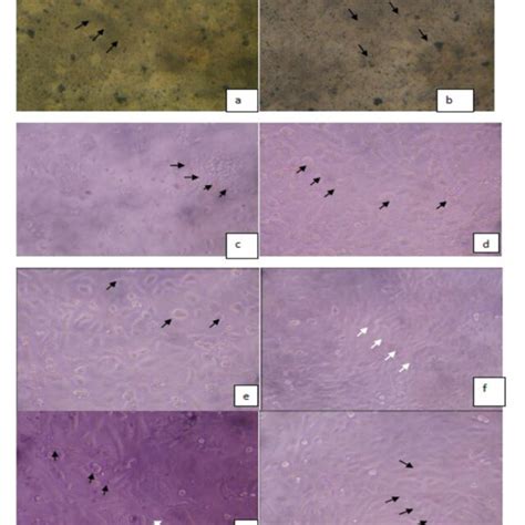 In Vitro Cytotoxicity Of Gold Nanoparticles Against Vero Cells At