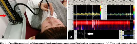 Figure 1 From Right To Left Shunt Detection Using Contrast Enhanced Transcranial Doppler A