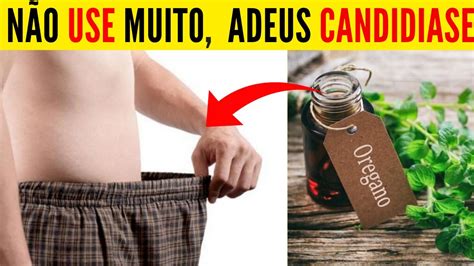 N O Use Muito Acaba De Vez A Candidiase Candidiase Masculina