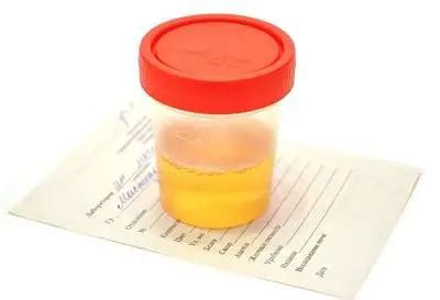 Smelly Urine in Male & Female - Main Causes of the Issue