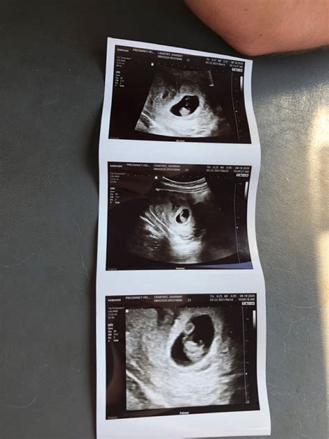 3 Weeks Pregnant Ultrasound Fake Ultrasound 4 Weeks Pregnant