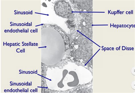 Liver And Gallbladder Histology Flashcards Quizlet