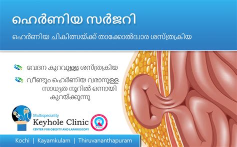 Hernia Surgery in Kerala, India | - Keyhole Clinic, Kochi