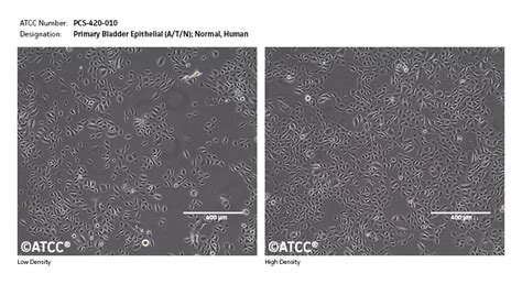 Primary Bladder Epithelial Cells Atn Normal Human Bdec Pcs