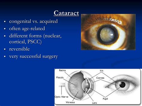 Ppt Introduction To Clinical Ophthalmology Powerpoint Presentation