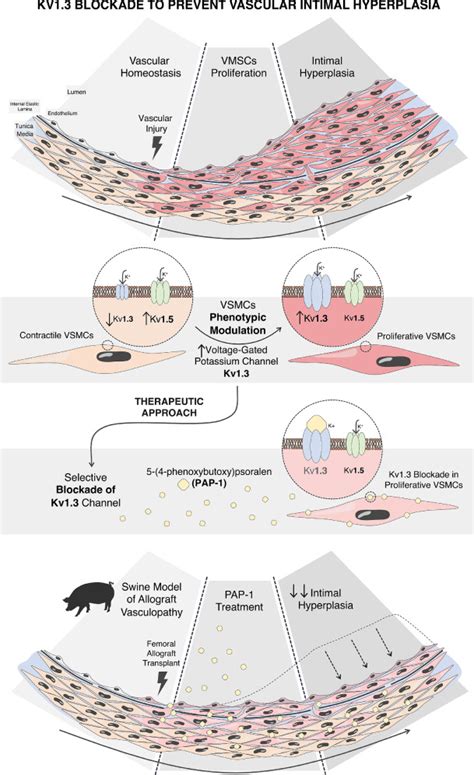 Kv1 3 Blockade Inhibits Proliferation Of Vascular Smooth Muscle Cells