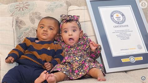 Worlds Most Premature Twins Celebrate Their First Birthday