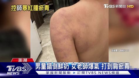 男童錯倒鮮奶 女老師爆氣 打到肩瘀青 Youtube