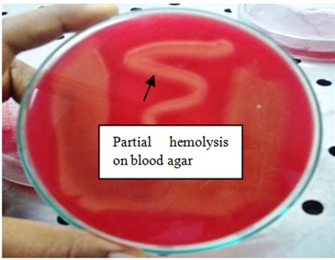 Bacillus Cereus Blood Agar