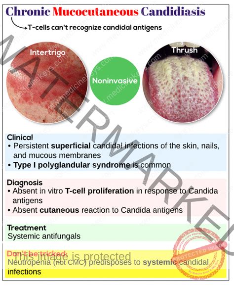 Chronic mucocutaneous candidiasis (CMC) - Medicine Keys for MRCPs