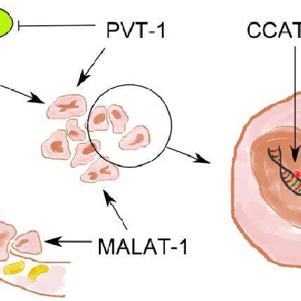 Lncrnas Being Involved In Molecular Pathogenesis Of Colorectal Cancer