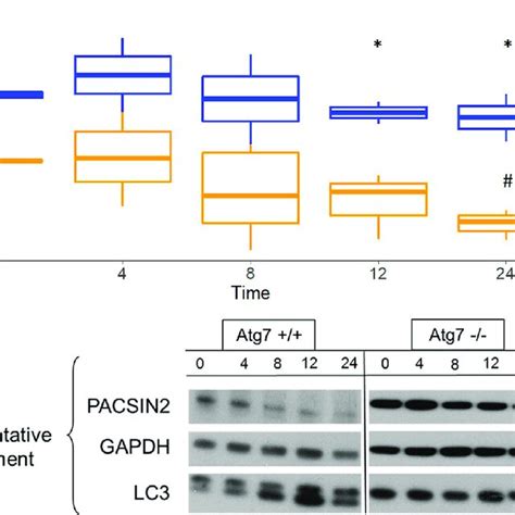 Pacsin Protein Expression Level Is Reduced In Autophagy Competent