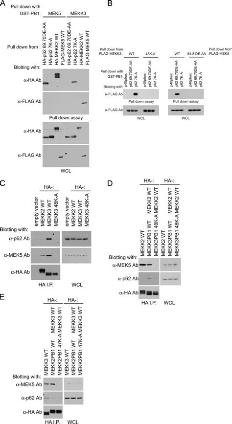 Pb Domain Interaction Of P Sequestosome And Mekk Regulates Nf B