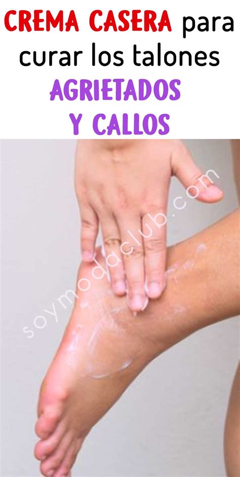 Remedio Casero Para Curar Los Talones Agrietados Y Callos Soy Moda