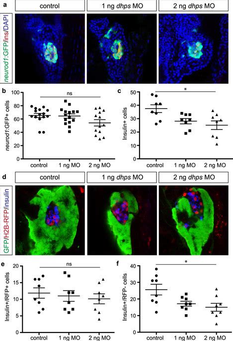 Knockdown of dhps inhibits β cell differentiation a Representative