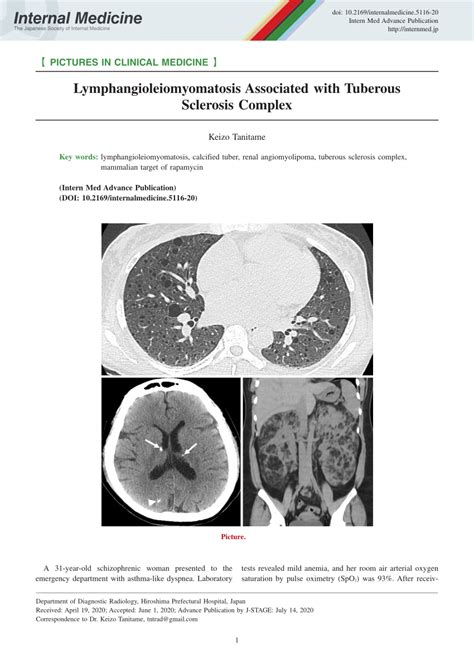 Pdf Lymphangioleiomyomatosis Associated With Tuberous Sclerosis Complex