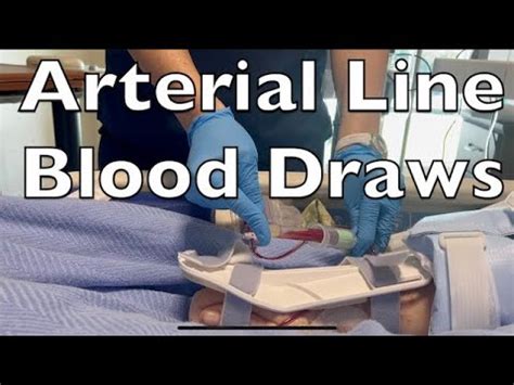 Drawing Blood From An Arterial Line YouTube